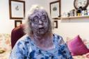 Jackie Weaver in her 'zombified' state